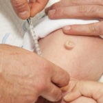 Circumcision