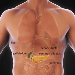 Laparoscopic Cholecystectomy