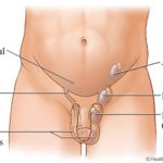 Undescended Testis